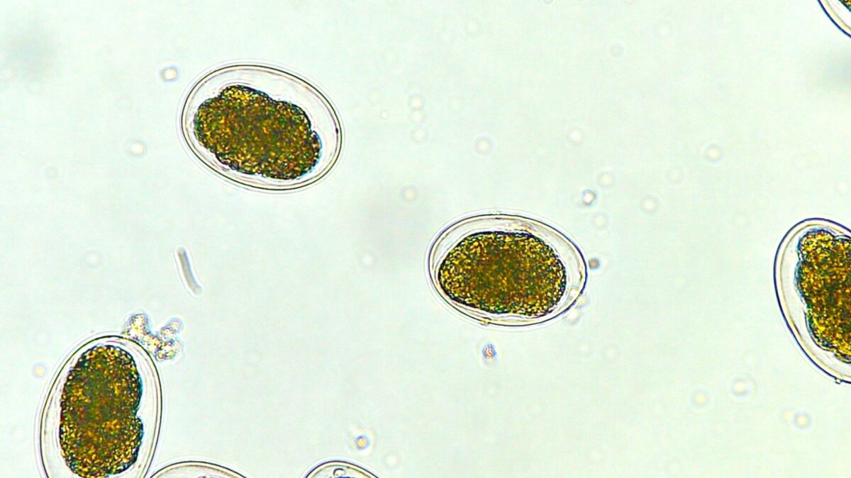 Hookworm eggs (Ancylostoma duodenale or Necator americanus) in stool examination, medical parasitology laboratory, helminthology